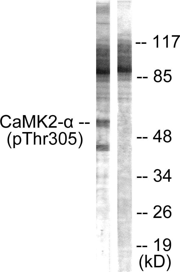 CaMKII Alpha+Beta+Delta Antibody (Ab-305)