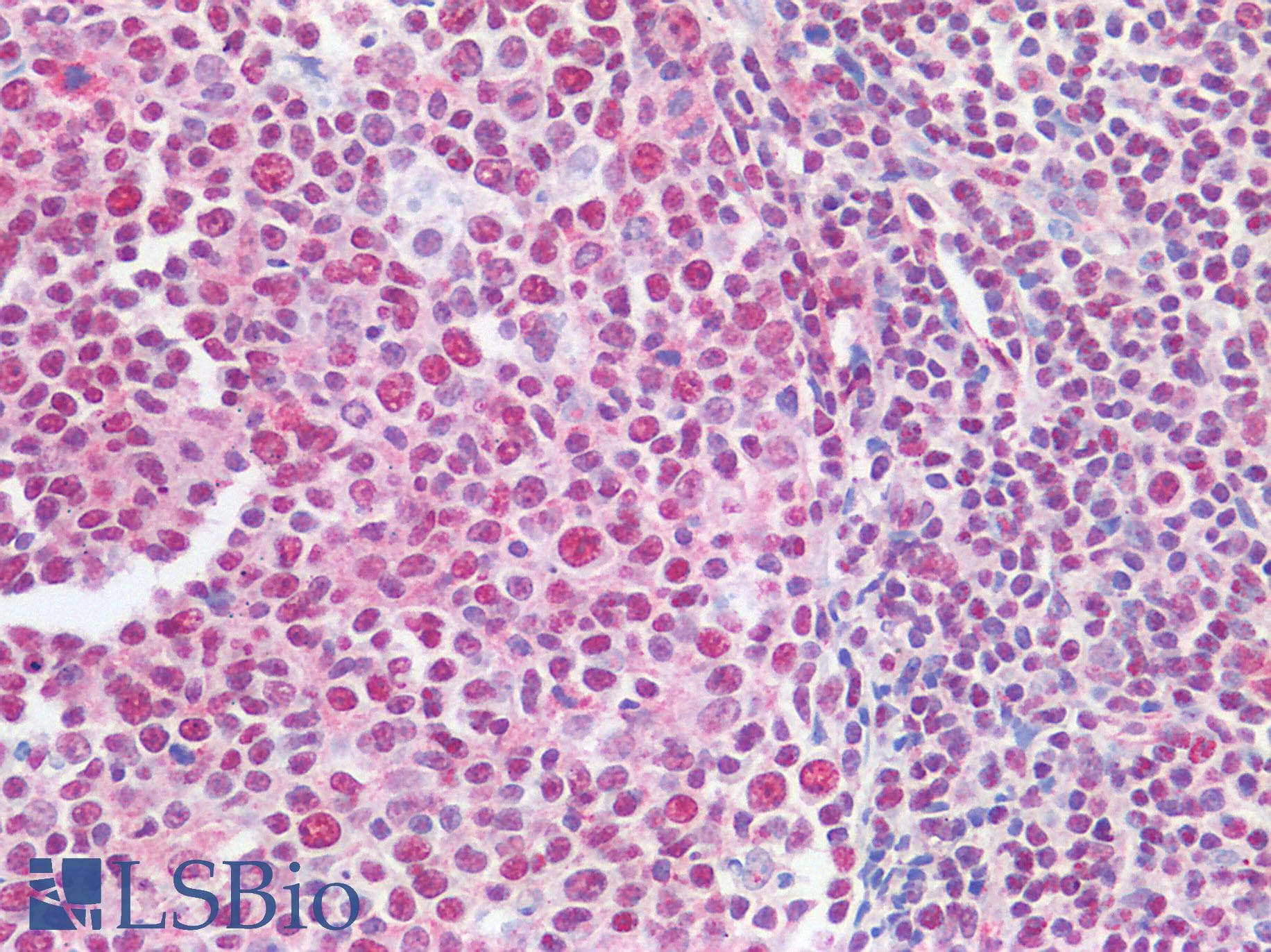 IHC-plus™ SNAI1 / SNAIL-1 Antibody (N-Terminus)