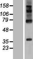 Human RHBDD2 Protein (Over-Expression Lysate Myc-DDK (Flag))