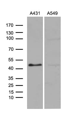 ELF3 / ESE1 Antibody (aa175-286, clone OTI6G6)