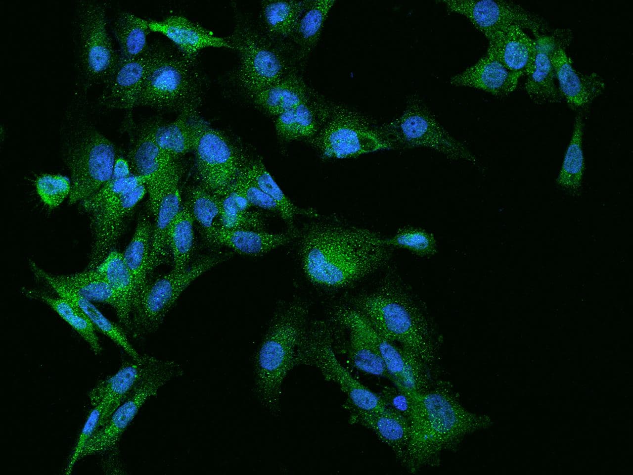 RABGEF1 Antibody