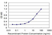 SPOP Antibody (clone 3E2)