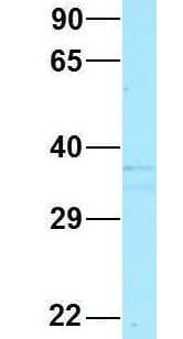SCN4 / G6PC3 Antibody (aa86-135)