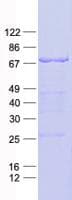 Human HNRPM / HNRNPM Protein (Recombinant His, N-Terminal)