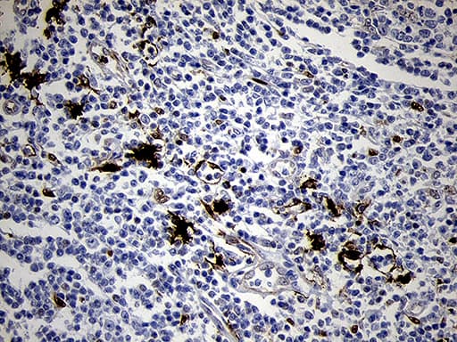 FSCN1 / Fascin Antibody (clone OTI3D2)