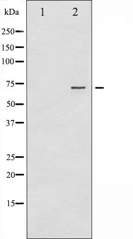 ER Alpha / Estrogen Receptor Antibody (phospho-Tyr537)