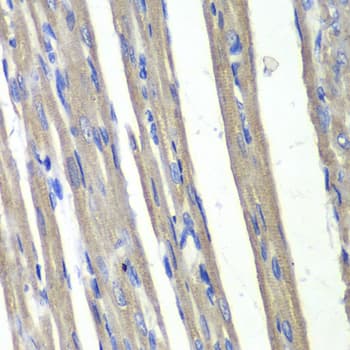 IHC-plus™ DDX / AKR1C3 Antibody