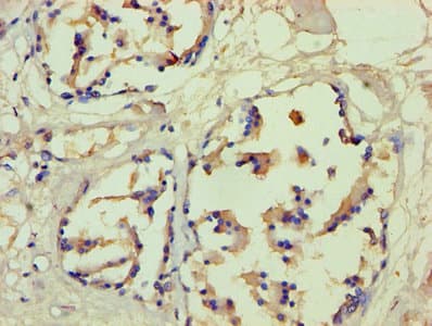 FLG / Filaggrin Antibody