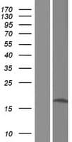 Human METTL21B / FAM119B Protein (Over-Expression Lysate Myc-DDK (Flag))