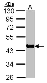 PathPlus™ Polyclonal Rabbit anti-Human ACTA1 / Skeletal Muscle Actin Antibody (IHC, WB)