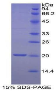 Human MOG Protein (Recombinant His-S)