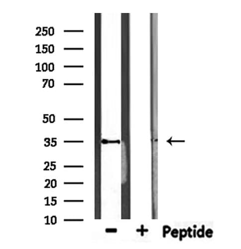 Polyclonal Rabbit anti-Human MAGE12 / MAGEA12 Antibody (IHC, WB)