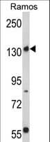 RICTOR Antibody (aa252-281)