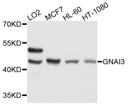 Polyclonal Rabbit anti-Human GNAI3 Antibody (WB)