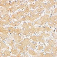 ATG4D Antibody