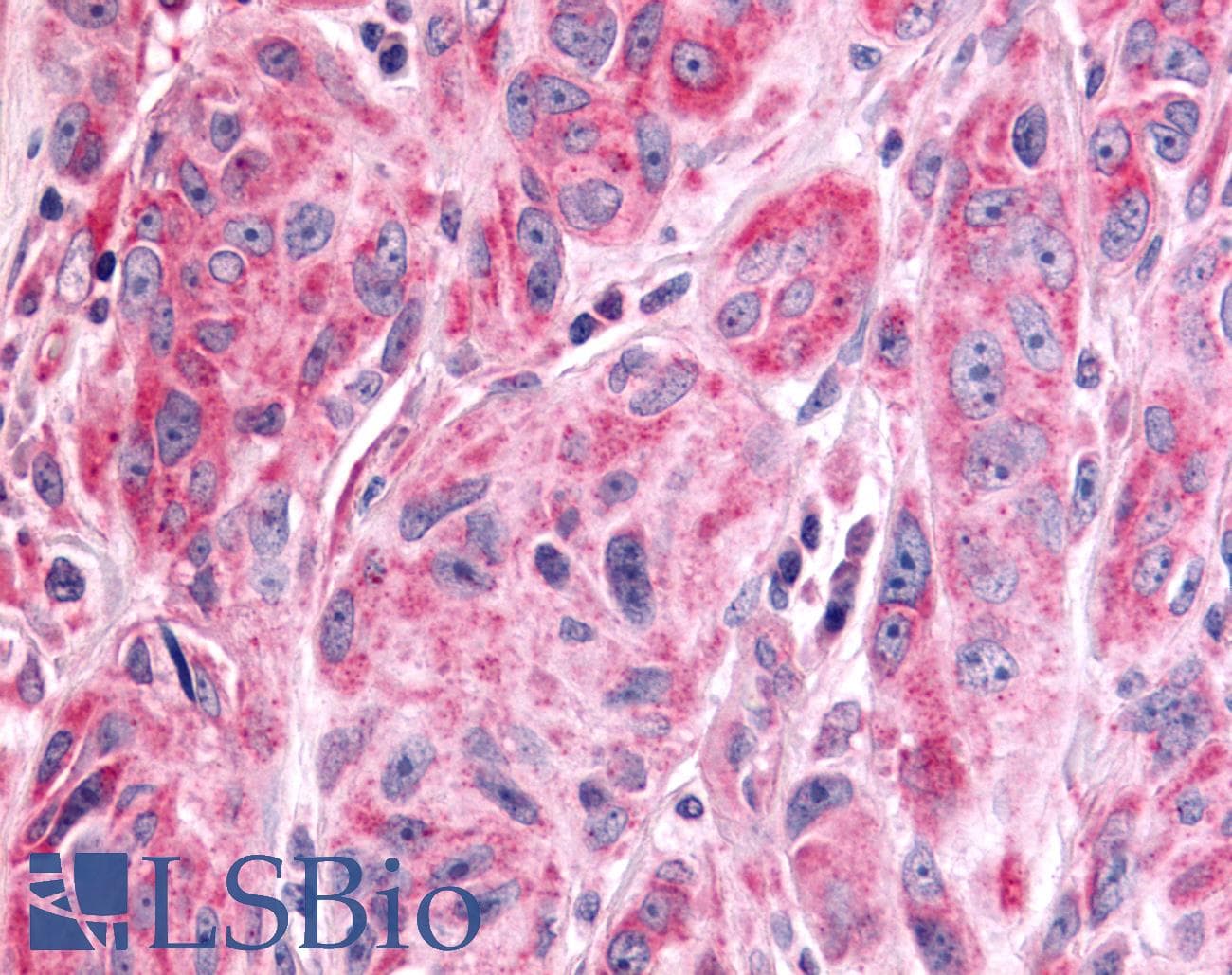 PathPlus™ PTPRE / PTP Epsilon Antibody (Cytoplasmic Domain)