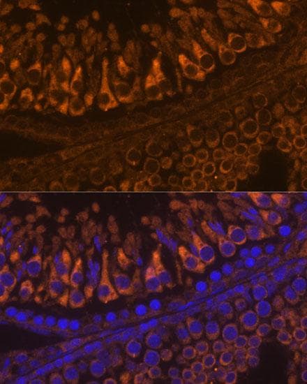 ELSPBP1 / HE12 Antibody