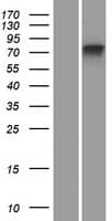 MTMR11 Protein (Over-Expression Lysate Myc-DDK (Flag))