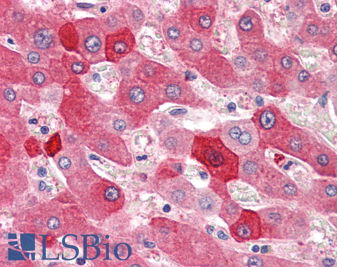 IHC-plus™ Polyclonal Rabbit anti-Human MYO5B / Myosin VB Antibody (C-Terminus, IHC, WB)