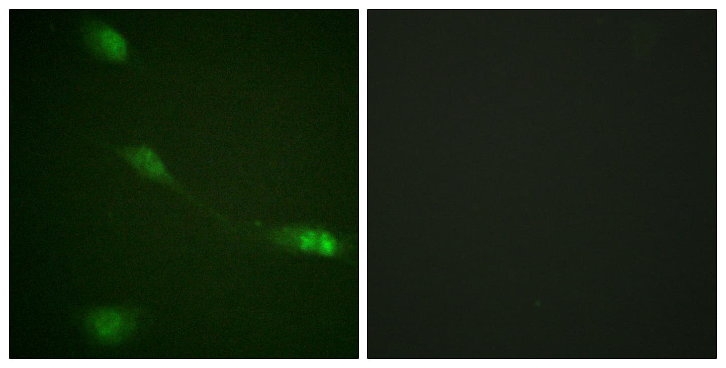 Polyclonal Rabbit anti-Human MDM2 Antibody (aa132-181, IF, WB)