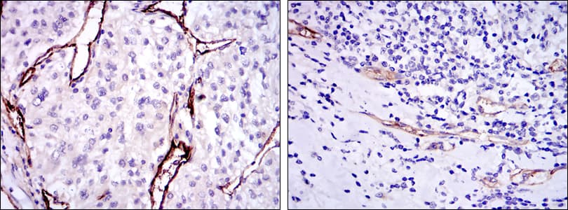 Monoclonal Mouse anti-Human CD105 Antibody (clone 3A9, IHC, IF, WB)