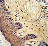 Polyclonal Rabbit anti-Human MCAM / CD146 Antibody (aa161-189, IHC, WB)