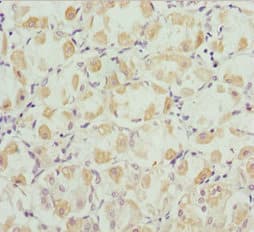 ROBO3 Antibody