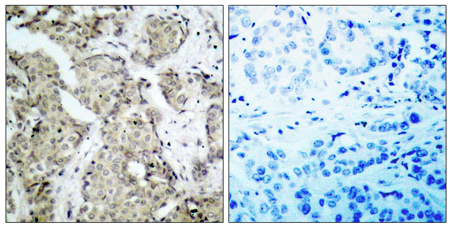 MAP2K3 / MEK3 / MKK3 Antibody (phospho-Ser189)