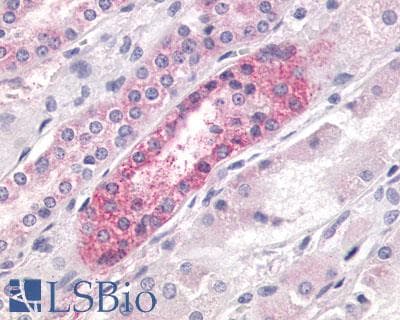 PathPlus™ LPAR4 / GPR23 Antibody (N-Terminus)
