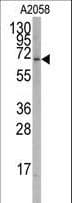 IHC-plus™ Polyclonal Rabbit anti-Human RORA / ROR Alpha Antibody (Thr216, IHC, IF, WB)