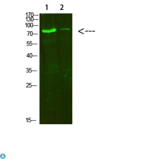 COL8A2 / Collagen VIII Antibody