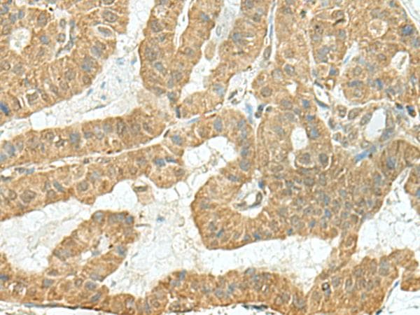 FAM46C Antibody