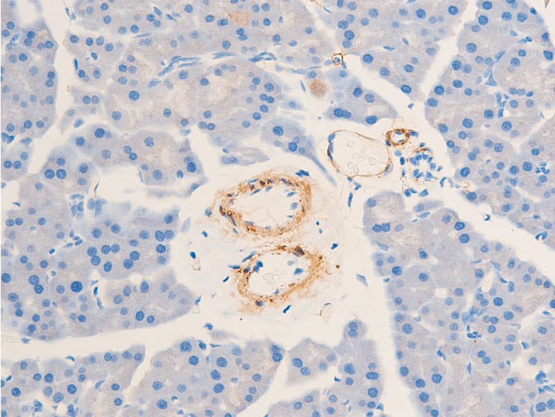 ACTA2 / Smooth Muscle Actin Antibody