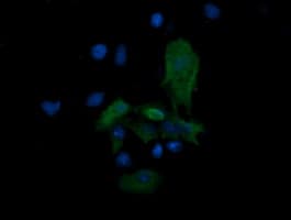 MAP2K3 / MEK3 / MKK3 Antibody (clone OTI1D3, Carrier-free)