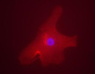MLXIPL / CHREBP Antibody (C-Terminus, DY650)