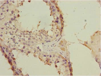FLVCR2 Antibody