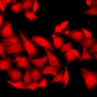 RPS6KA3 / RSK2 Antibody