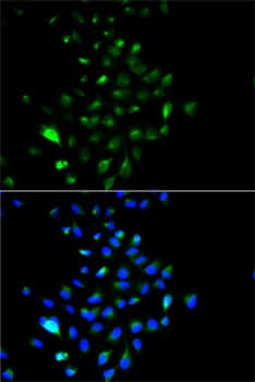 Polyclonal Rabbit anti-Human JUP/CTNNG/Junction Plakoglobin Antibody (IHC, IF, WB)