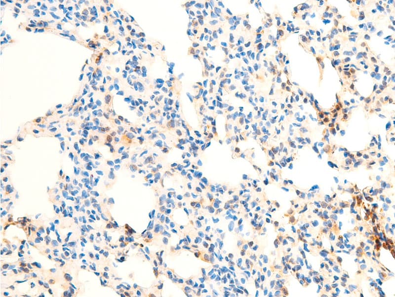 RELA / NFKB p65 Antibody (phospho-Ser536)