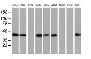 ARFGAP1 Antibody (clone OTI2C6)