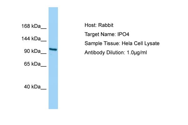 Polyclonal Rabbit anti-Human IPO4 Antibody (aa468-517, WB)
