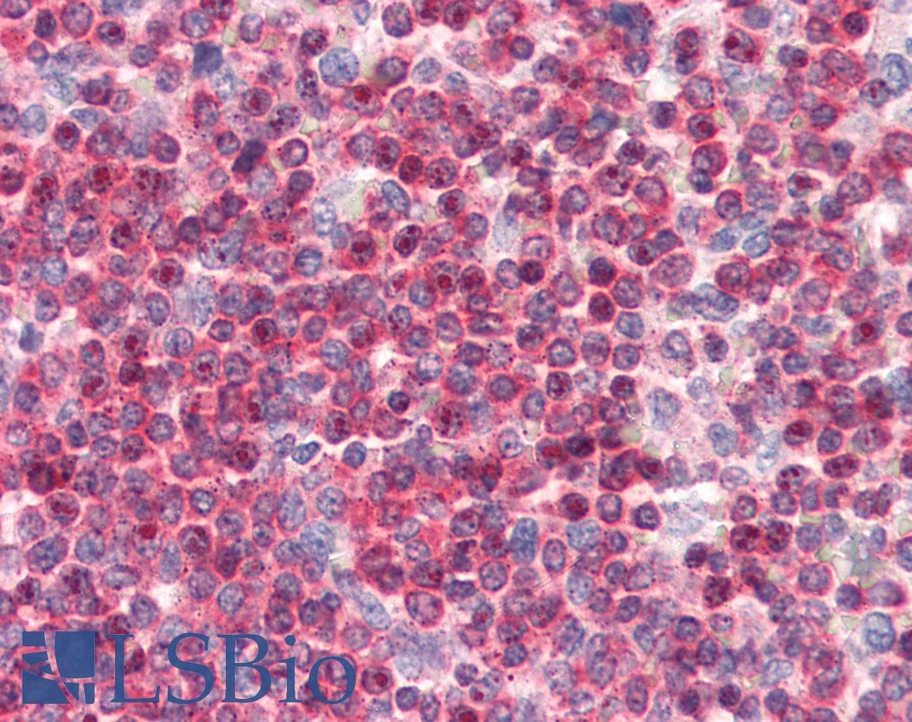 PathPlus™ Polyclonal Goat anti-Human CORO1A / Coronin 1a Antibody (aa546-558, IHC, WB)