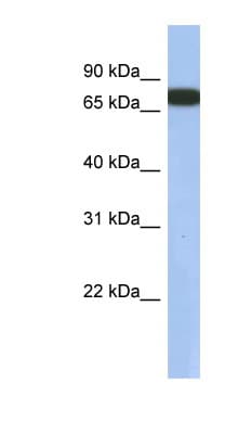 GNL3L Antibody (aa71-120)