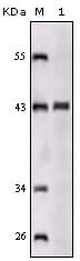 IHC-plus™ Monoclonal Mouse anti-Human SORL1 Antibody (clone 3B6B11, aa2158-2214, IHC, IF, WB)
