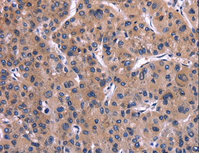IL1A / IL-1 Alpha Antibody