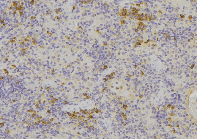 Polyclonal Rabbit anti-Human MIF Antibody (IHC, WB)