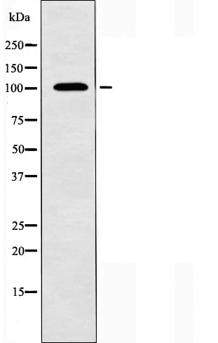 NCAM2 Antibody