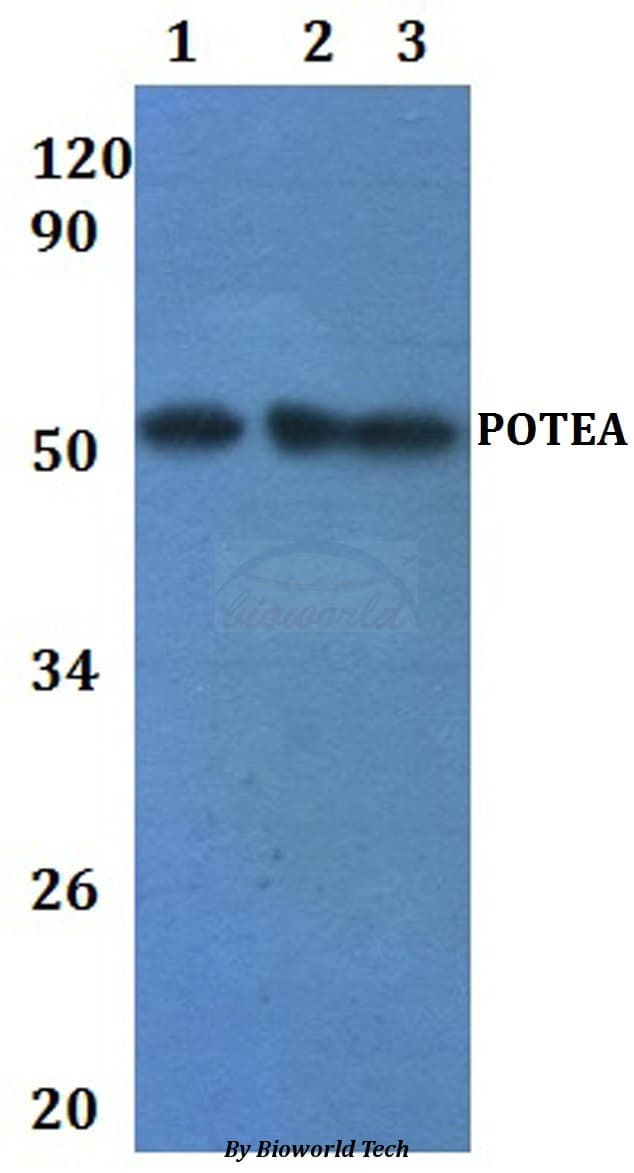 Polyclonal Rabbit anti-Human POTEA / POTE8 Antibody (WB)
