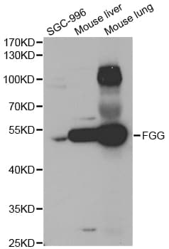 IHC-plus™ FGG / Fibrinogen Gamma Antibody