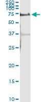 ALPPL2 Antibody (clone 2B3)